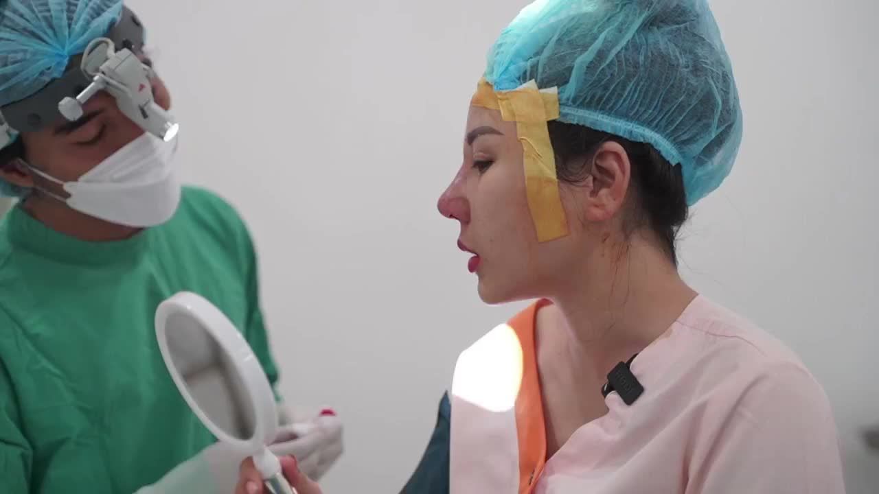 Ca nâng mũi cấu trúc sụn tai