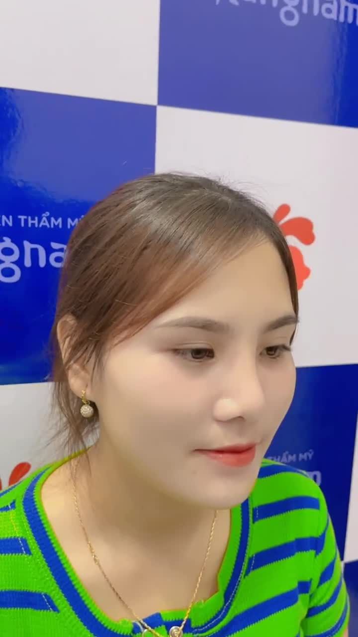 Thăng hạng nhan sắc - Dáng mũi đẹp tự nhiên với Nâng mũi 6D nhà Kangnam