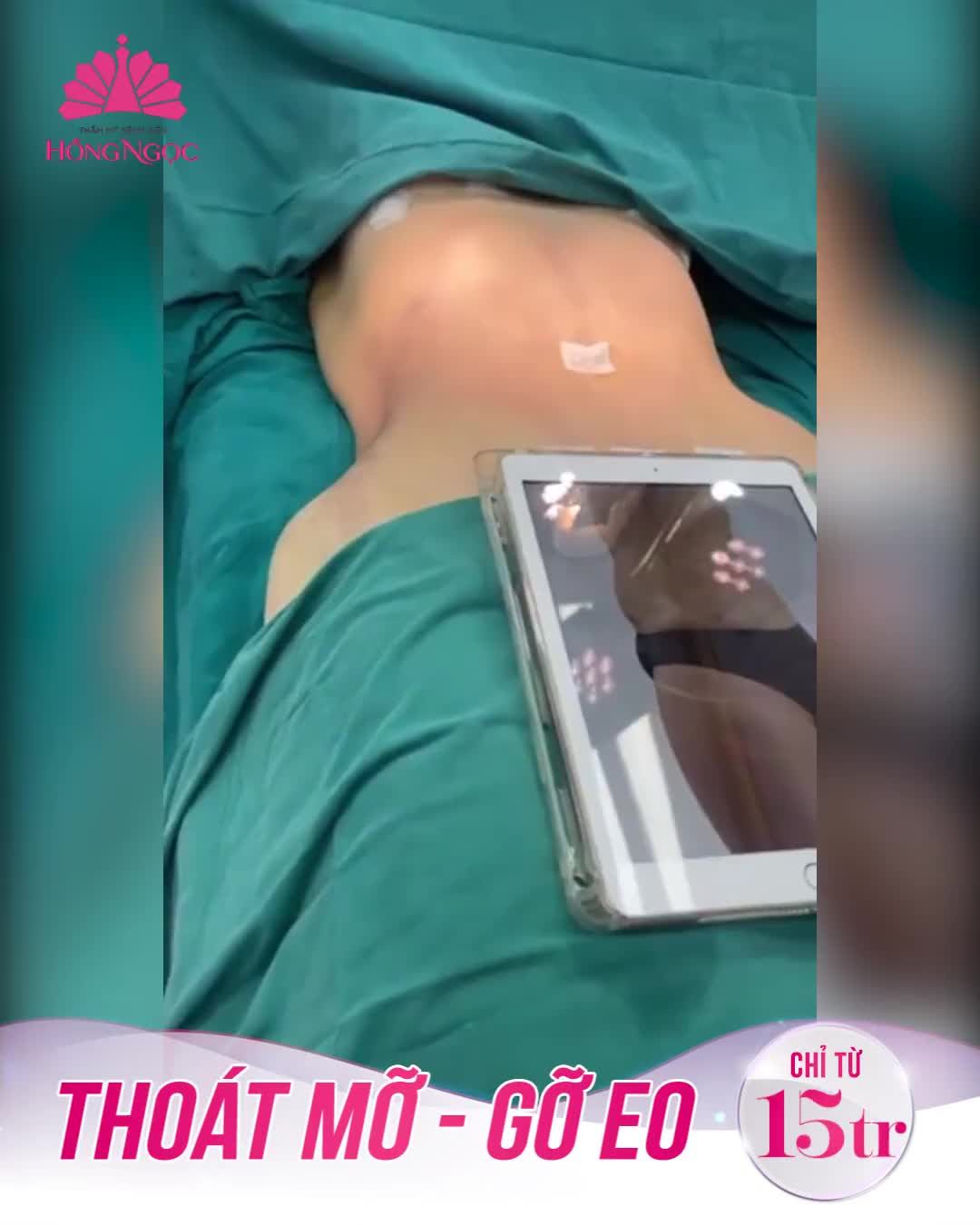 SỞ HỮU BODY THẮT ĐÁY LƯNG ONG CHỈ SAU 90P HÚT MO