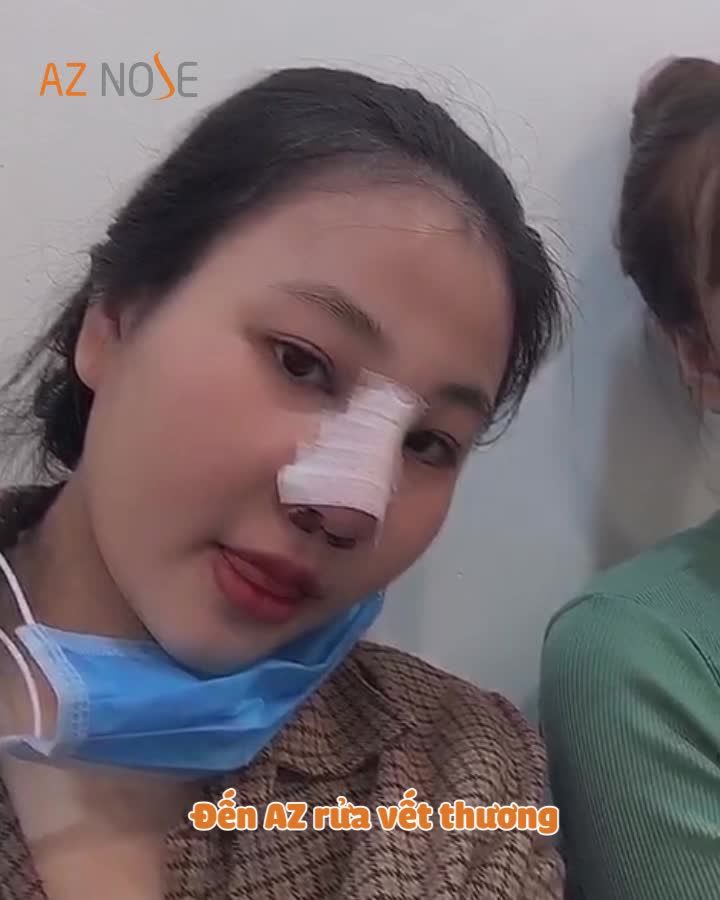 Cùng nhau đi nâng mũi và cái kết... bất ngờ hông bà dà...