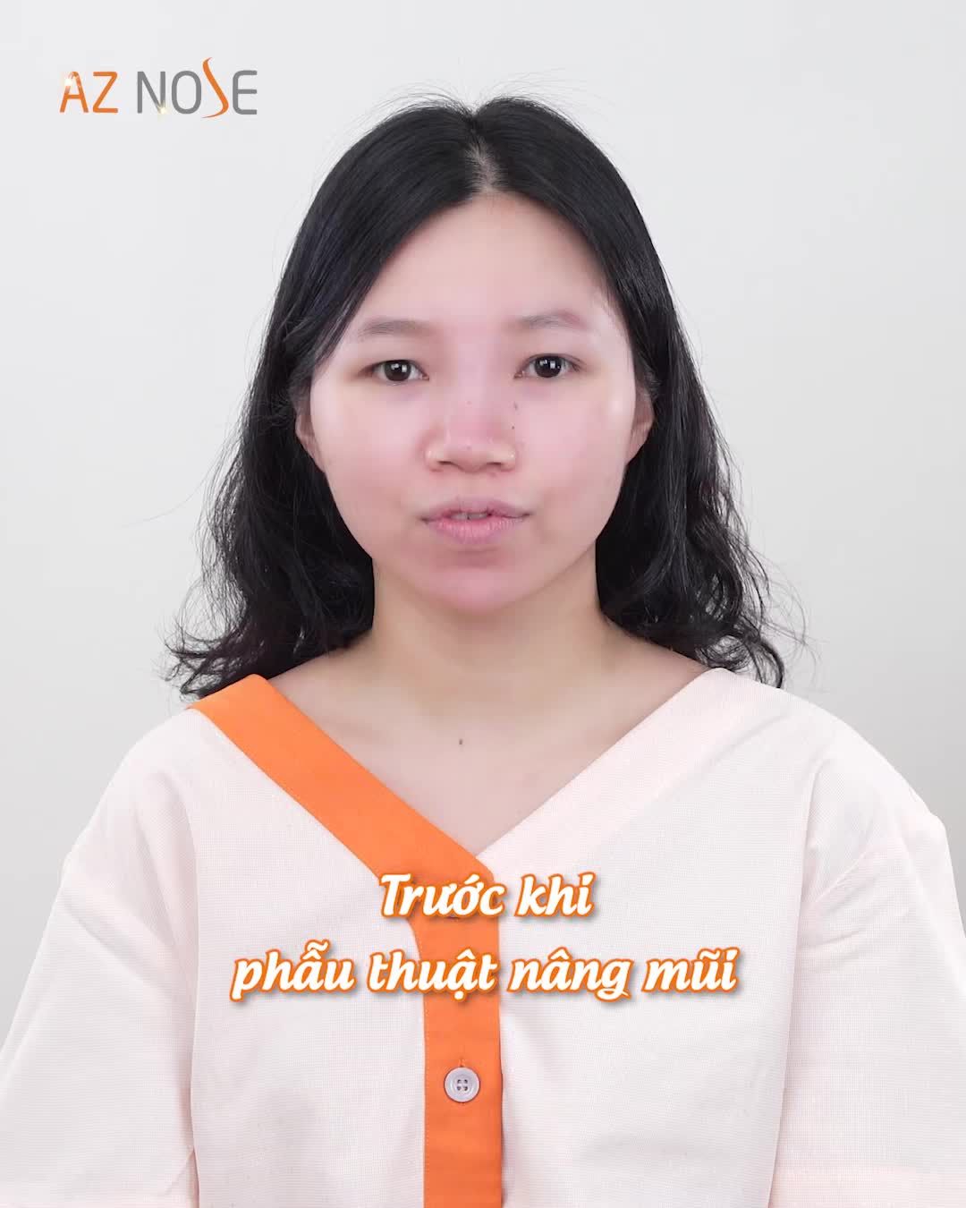 Từ Philippines về Việt Nam nâng mũi và cái kết ngọt ngào