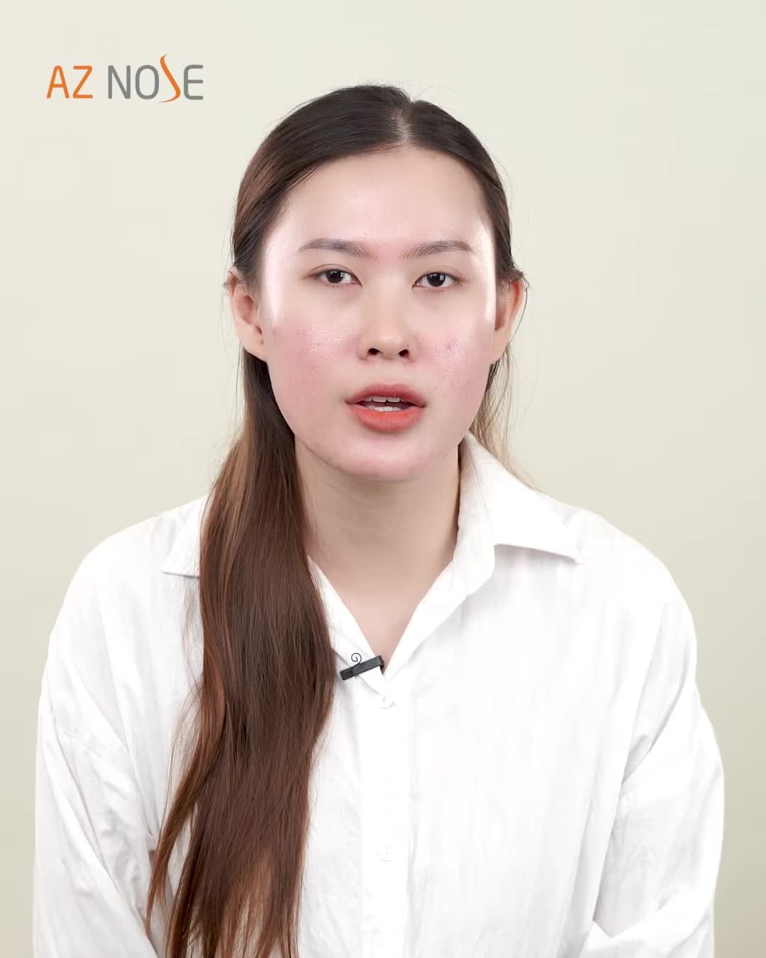 Vì đam mê chụp ảnh góc nghiêng mà quyết tâm nâng mũi