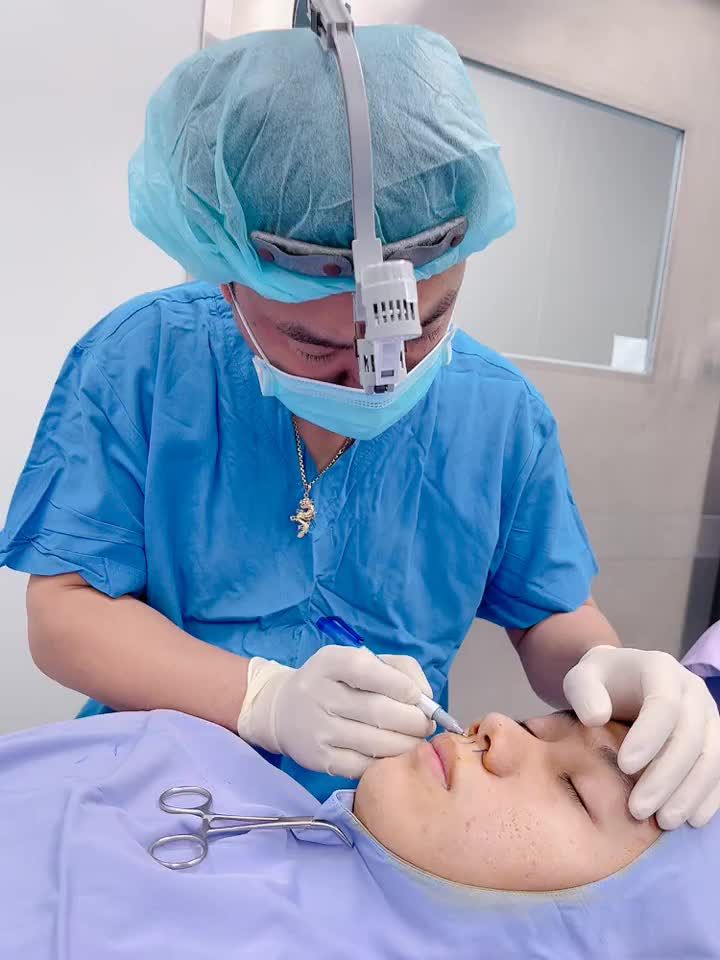 Với dáng mũi cao nhưng khuyết điểm cánh mũi to dày thì CuộnThu gọn cánh mũi là dịch vụ vô cùng phù hợp cho khách hàng