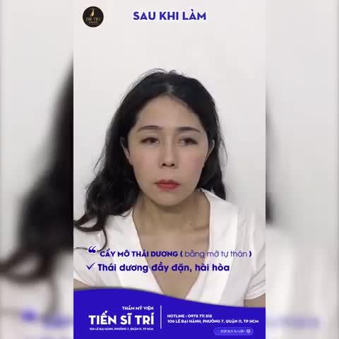 Cơ thể bị lão hóa, vùng thái dương lõm xuống khiến mặt chị khách bị hốc hác, thiếu sức sống