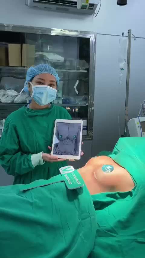 Ca Nâng ngực vừa được thực hiện bởi ekip Dr. Minh Phạm