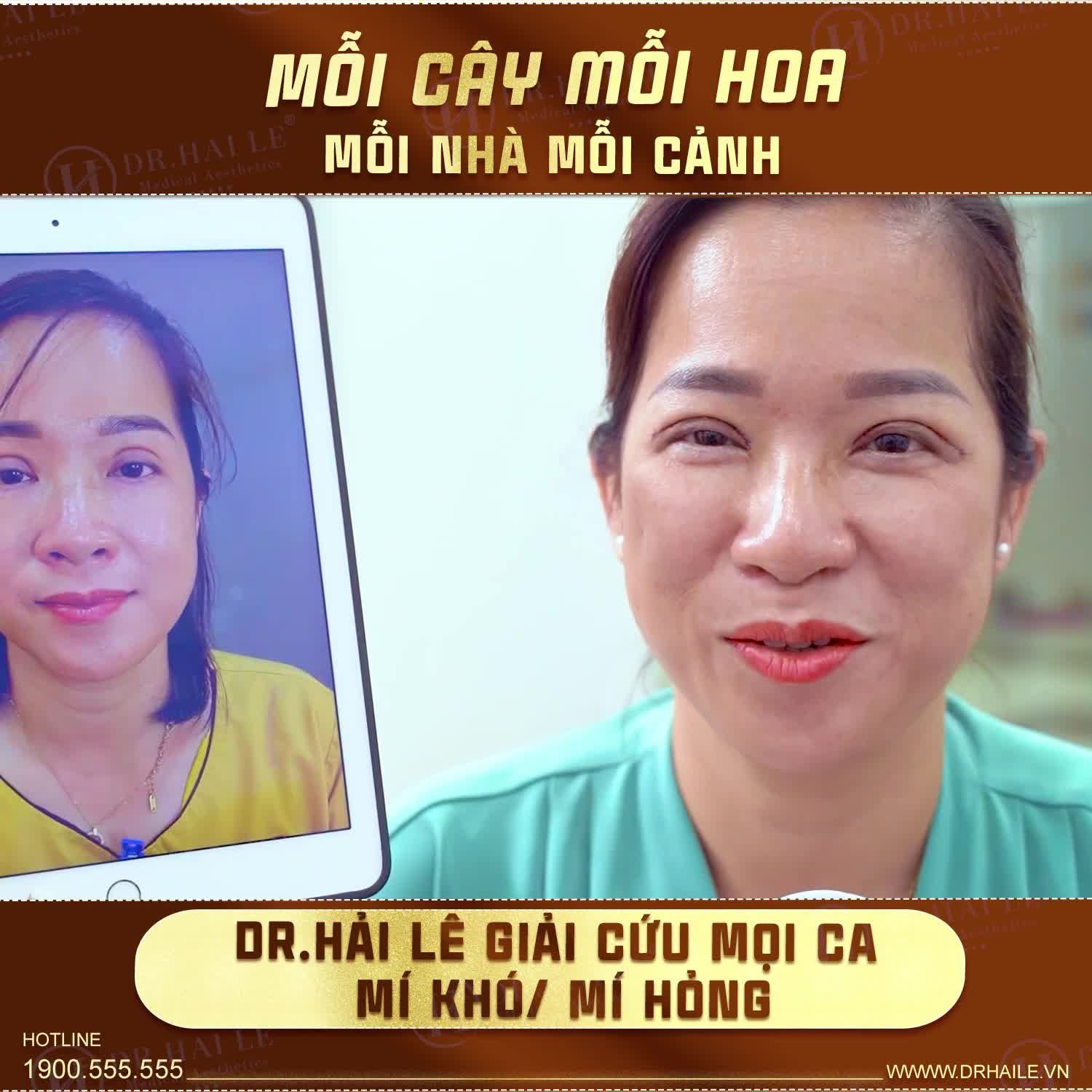 Mỗi cây mỗi hoa, mỗi nhà mỗi cảnh  Mỗi ca mí có một khuyết điểm khác nhau