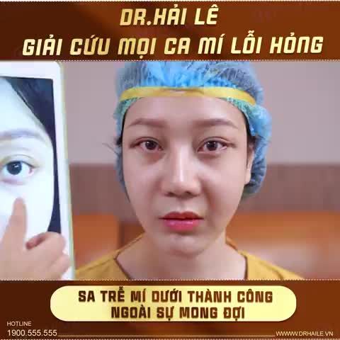 Dr.Hải Lê giải cứu mọi ca mí lỗi hỏng Trên Dưới