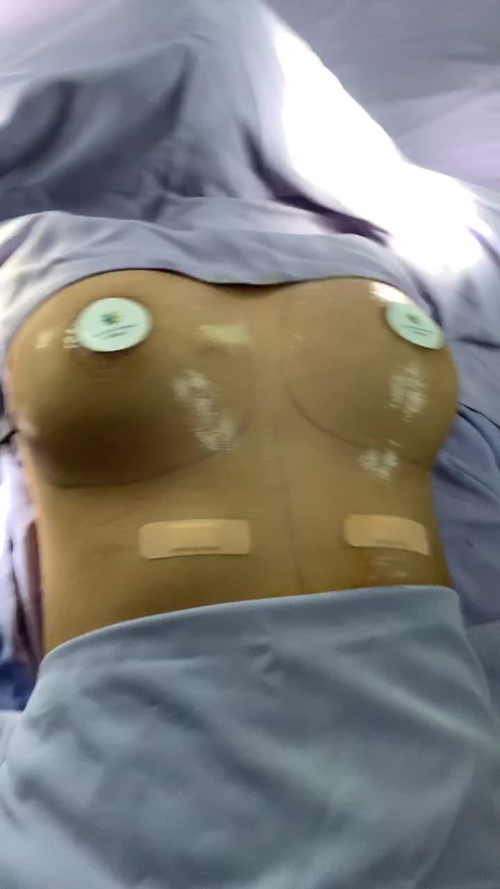 Kết quả nâng ngực tại Bệnh viện thẩm mỹ Đông Á