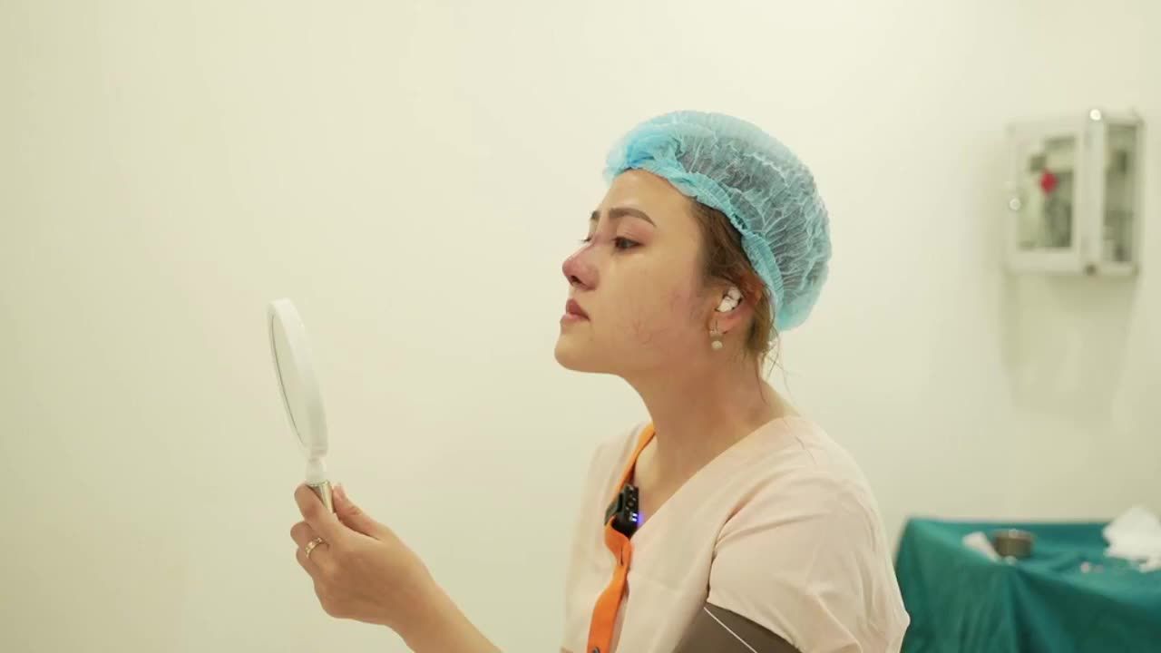 Ca nâng mũi cấu trúc sụn tai