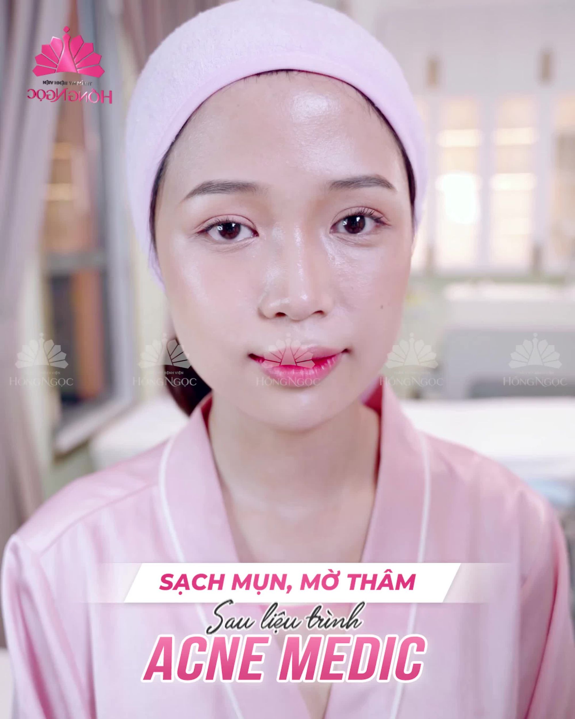 ĐỂ MỤN KHÔNG CÒN LÀ CƠN ÁC MỘNG NHỜ CN SIÊU TRỊ MỤN ACNE MEDIC