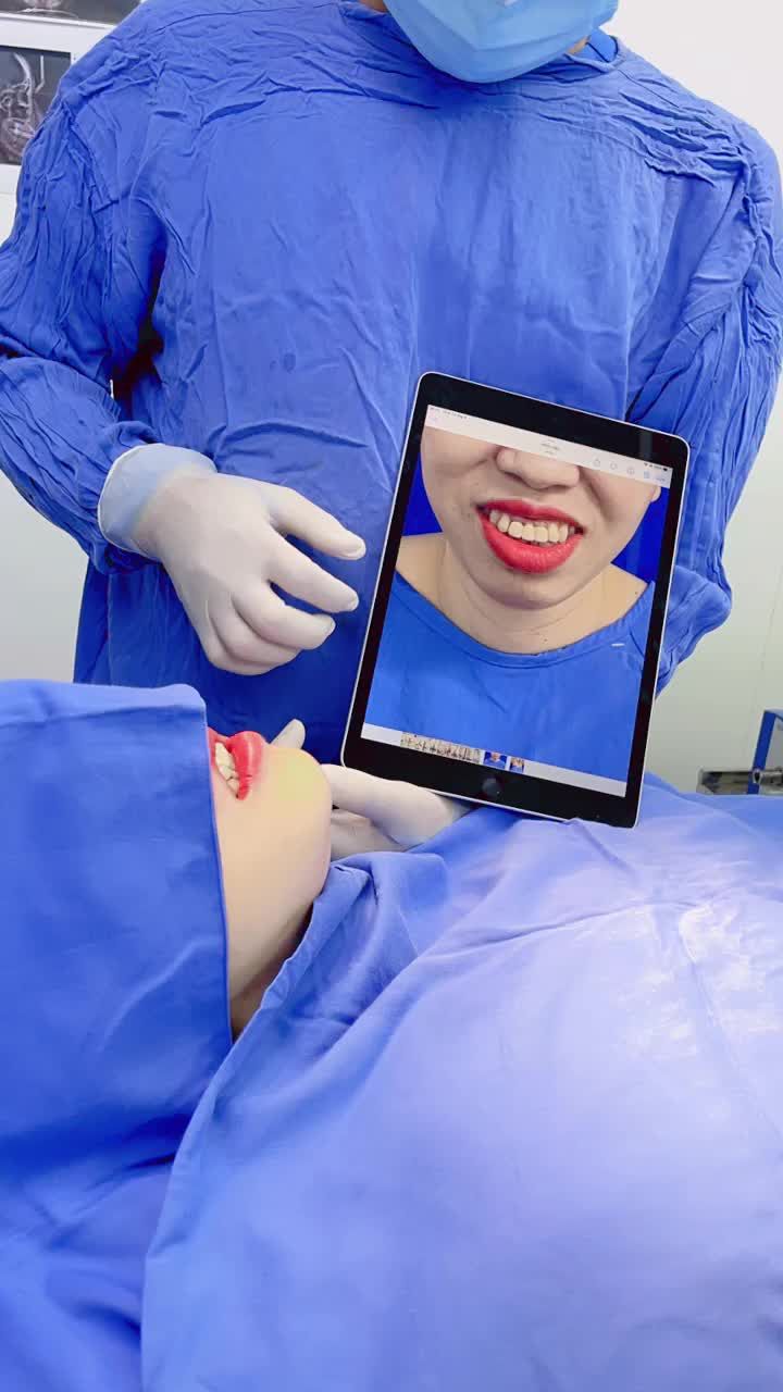 BẤT NGỜ trước Kết quả phẫu thuật Combo Hàm hô 2 hàm - Trượt cằm - Chữa cười hở lợi siêu lớn