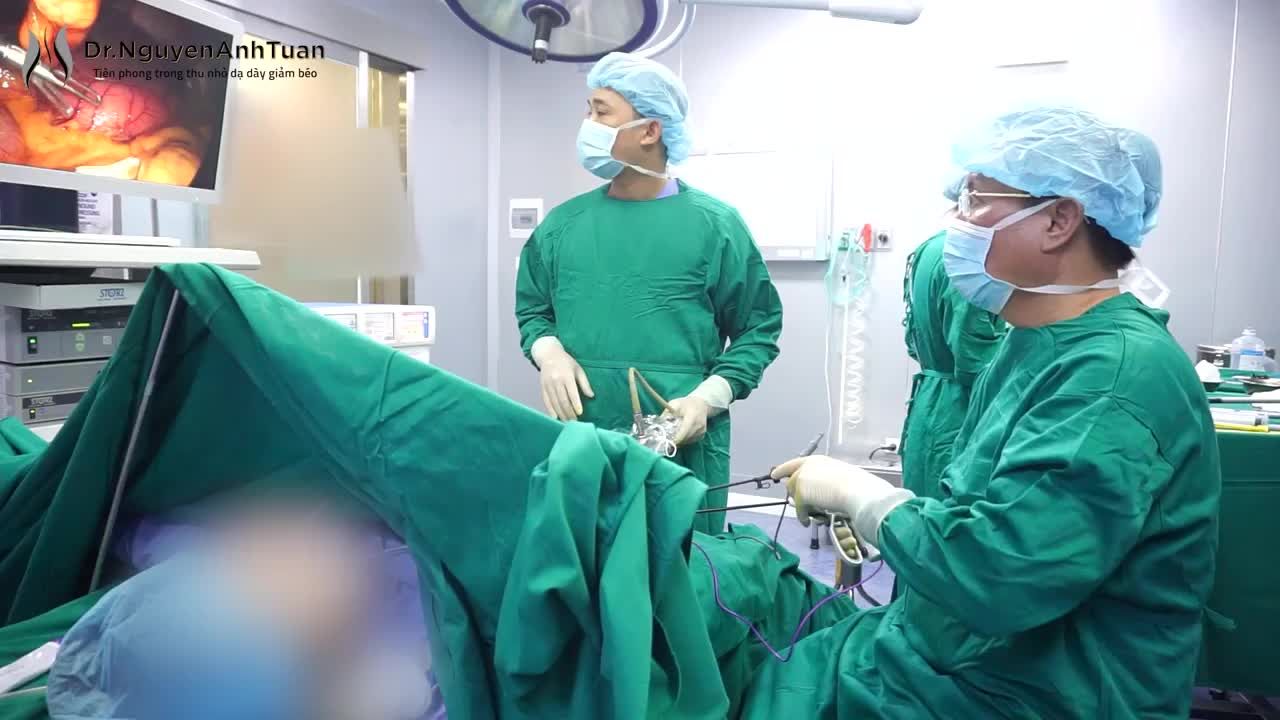 Phẫu thuật thu nhỏ dạ dày cho bệnh nhân béo phì độ II, có polyp 0,2cm ở hành tá tràng.