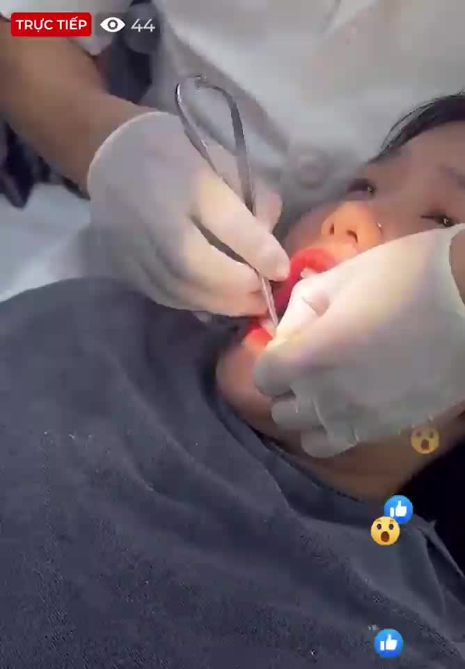 BS THAY DÂY CUNG CHO KHÁCH HÀNG