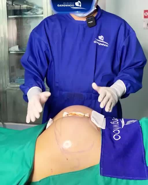 CA NÂNG MÔNG NỘI SOI HÀN QUỐC