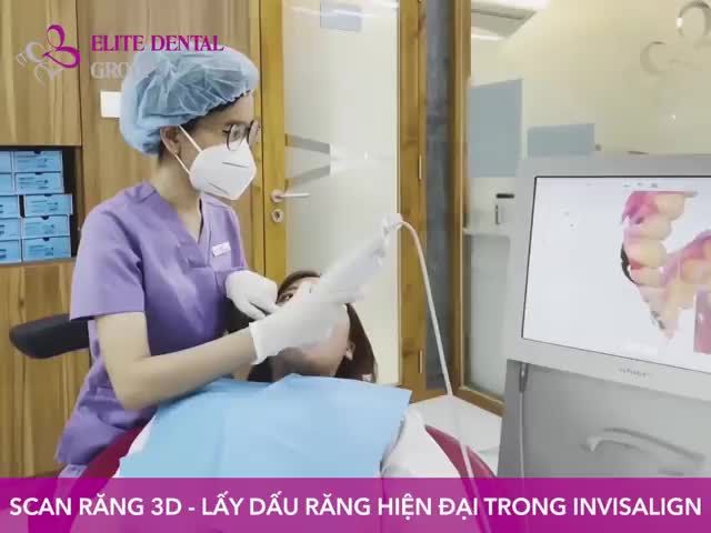 CẬN CẢNH SCAN RĂNG 3D NIỀNG RĂNG INVISALIGN TẠI ELITE