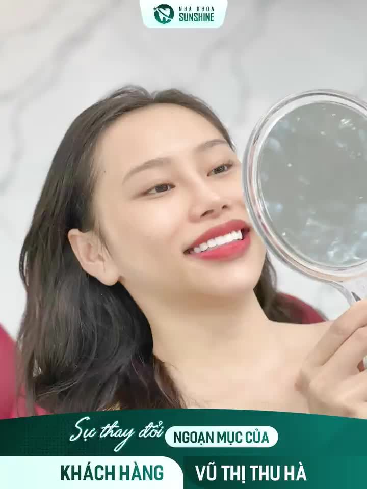 RĂNG SỨ GIÚP KHẮC PHỤC MỌI KHUYẾT ĐIỂM