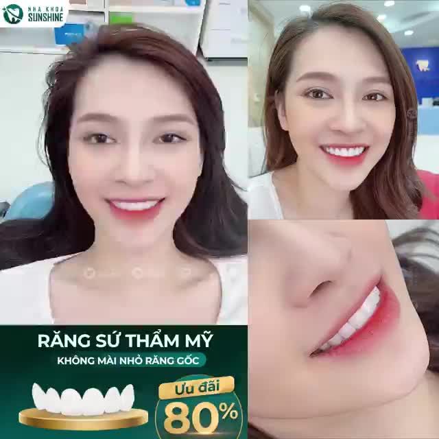 Độc Quyền Về Công Nghệ Mài Răng Được Tìm Kiếm Nhiều Nhất Hiện Nay