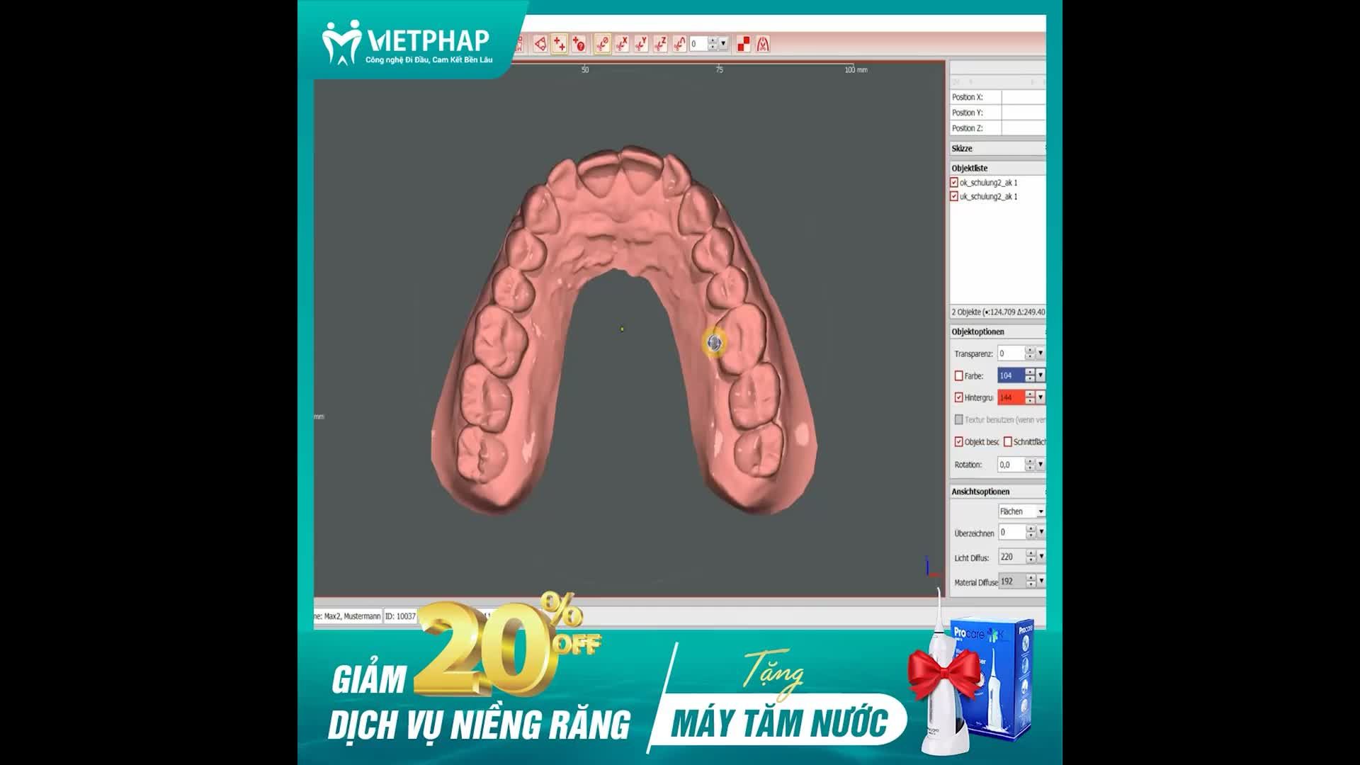 GIẢM THỜI GIAN NIỀNG RĂNG LÊN TỚI 6 THÁNG VỚI CÔNG NGHỆ SMART CLIP