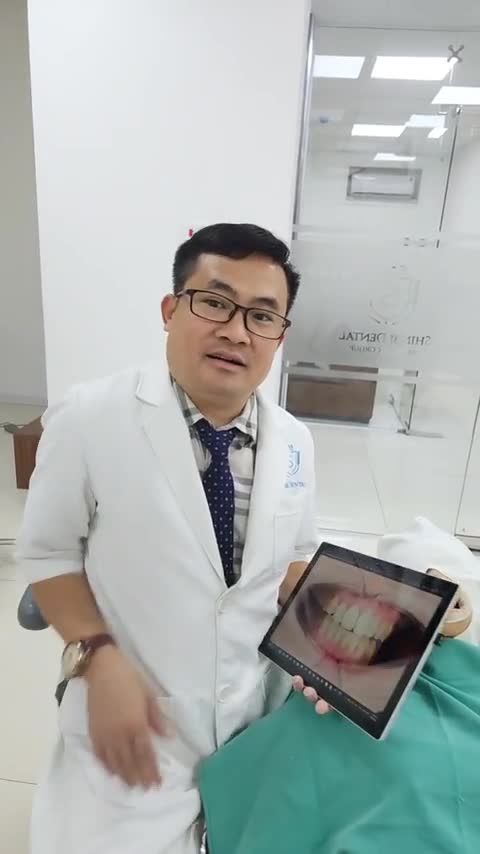 Kết quả hoàn thành ca thẩm mỹ 20 răng tại Shinbi Bắc Ninh chiều nay 189 bởi BS. CKI Thân Ngọc Kiên