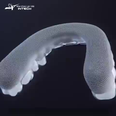 KHAY NIỀNG INVISALIGN HOẠT ĐỘNG NHƯ THẾ NÀO