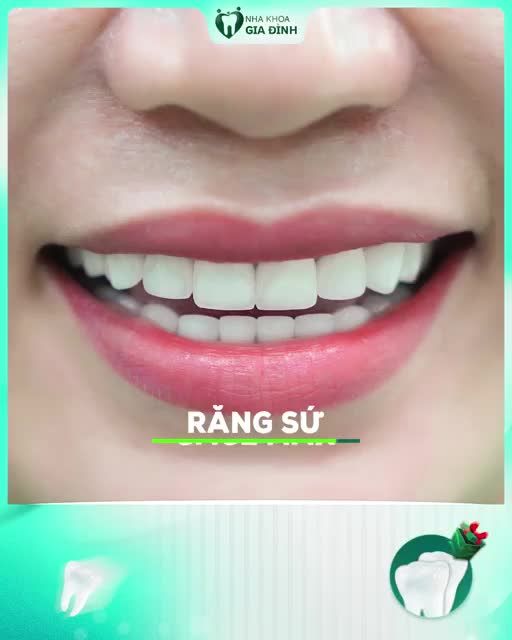KHÔNG TỰ TIN VỚI HÀM RĂNG HIỆN TẠI, CHỊ KHÁCH QUYẾT TÂM THAY ĐỔI