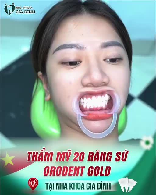 LÀM TẤT CẢ ĐỂ CÓ HÀM RĂNG ĐỀU ĐẸP, TRẮNG SÁNG