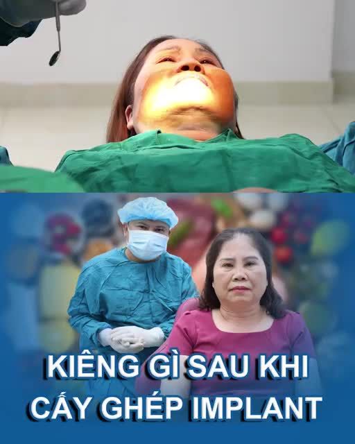NÊN KIÊNG GÌ SAU KHI CẤY GHÉP IMPLANT