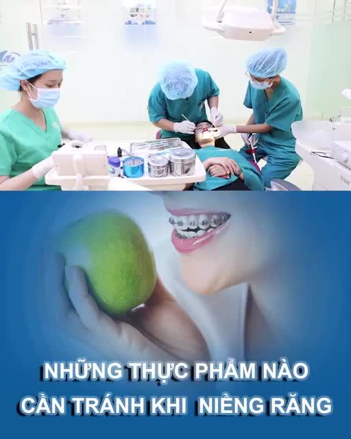 Những thực phẩm nào cần tránh khi mang niềng răng