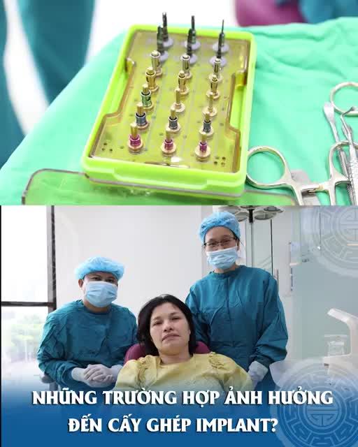 Những trường hợp ảnh hưởng đến cấy ghép Implant