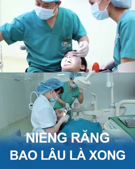 Niềng răng bao lâu thì xong
