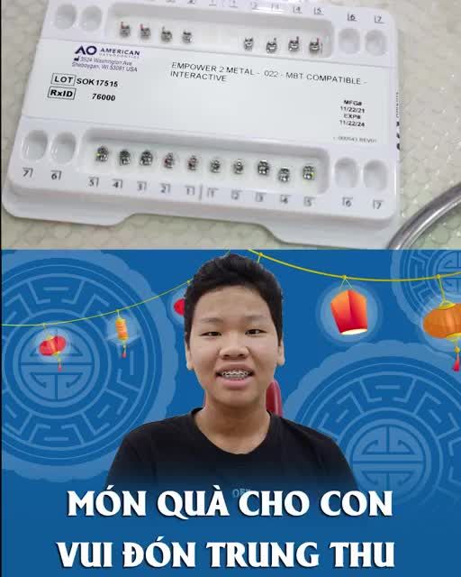 Niềng răng càng sớm tiết kiệm tối đa chi phí niềng răng so với khi lớn tuổi.