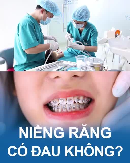 Niềng răng có đau không