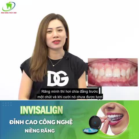 NIỀNG RĂNG HÔ CÙNG INVISALIGN VÀ BS. TRẦN THUỲ ANH