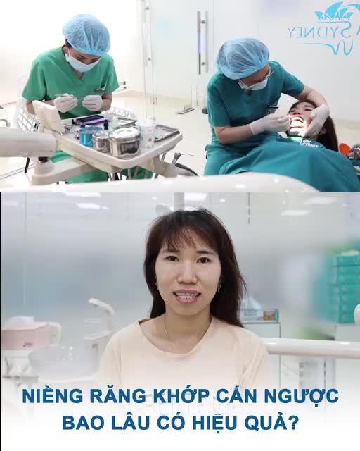 Niềng răng khớp cắn ngược bao lâu thì hiệu quả