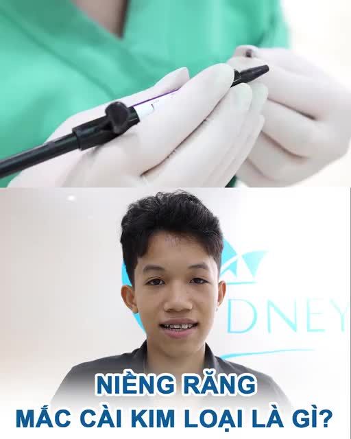 Niềng răng mắc cài kim loại là gì