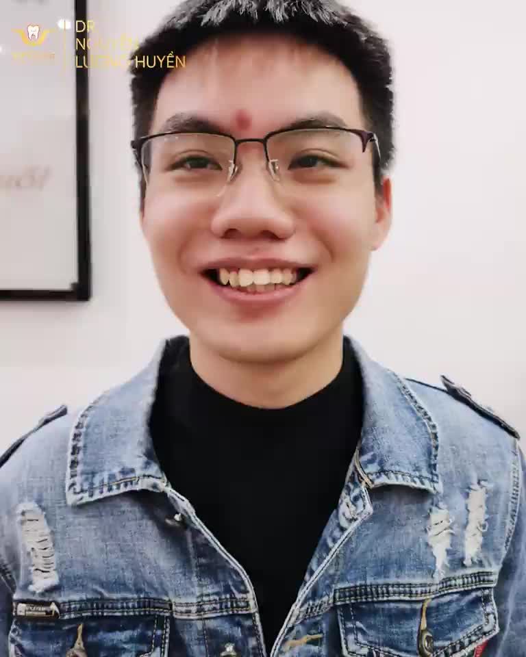 NIỀNG RĂNG SUỐT 1 NĂM QUA NHƯNG KHÔNG AI HAY BIẾT