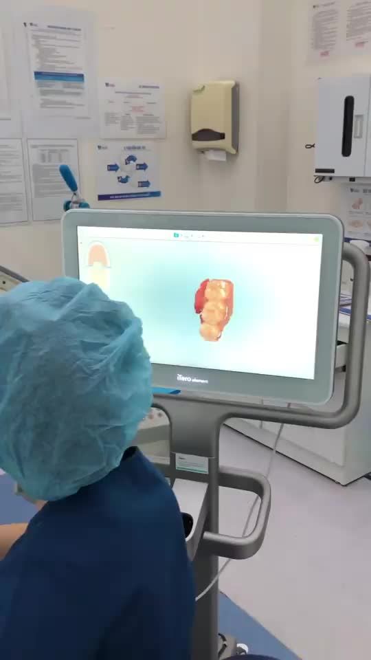 Quá trình scan chỉnh nha