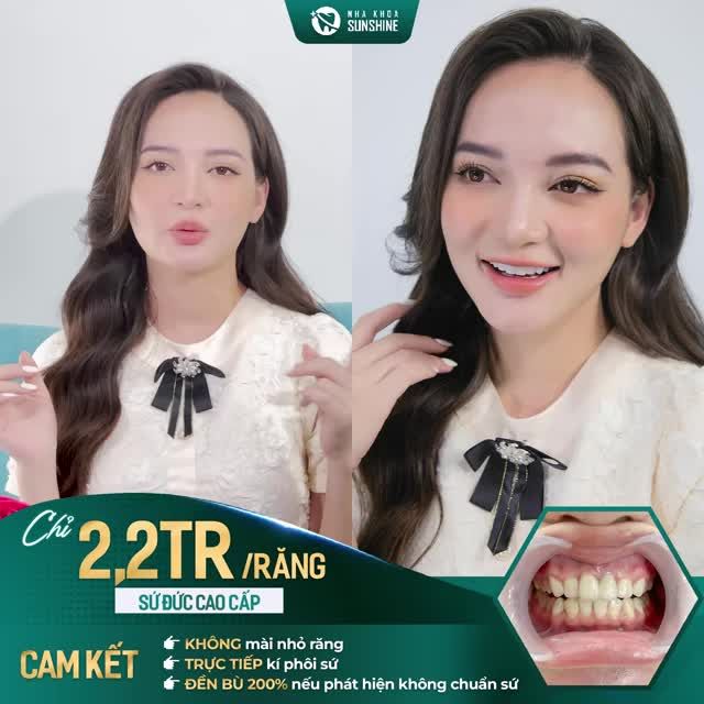 RĂNG ĐẸP TRỌN ĐỜI VỚI CÔNG NGHỆ BẢO TỒN TỐI ĐA RĂNG GỐC