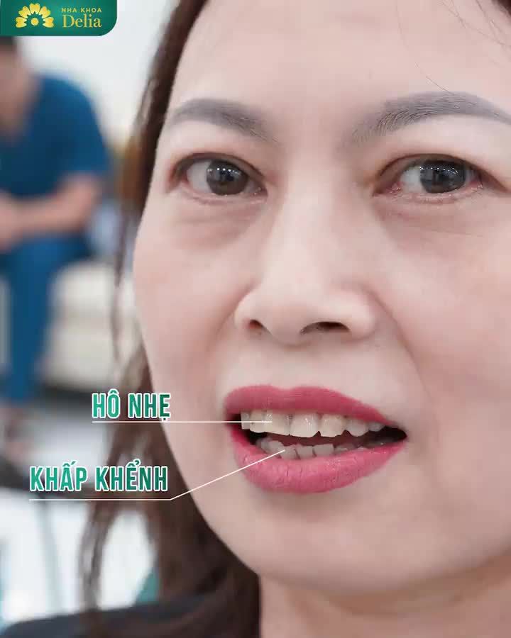 Răng nhiễm Tetracycline khiến chị KH Nguyễn Thị Hoa tự ti, ngại giao tiếp trong cuộc sống và công việc.