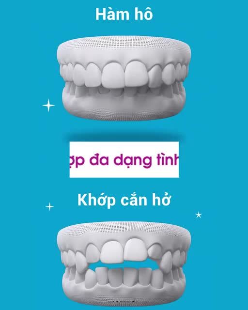 TẠI SAO NIỀNG RĂNG INVISALIGN CÙNG ELITE DENTAL LÀ ĐẦU TƯ XỨNG ĐÁNG