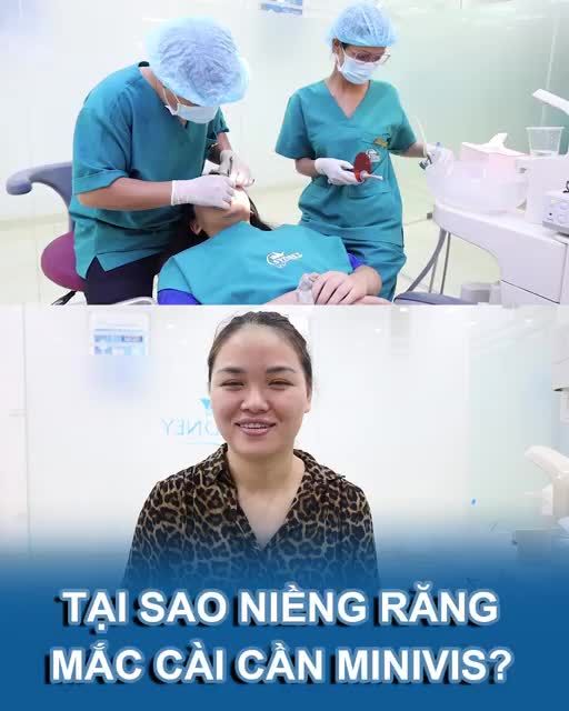 Tại sao niềng răng mắc cài cần minivis