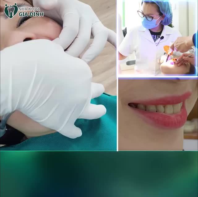 TIN ĐƯỢC KHÔNG LÀM RĂNG TOÀN SỨ CHÍNH HÃNG CHỈ TỪ 24TR TRỌN BỘ