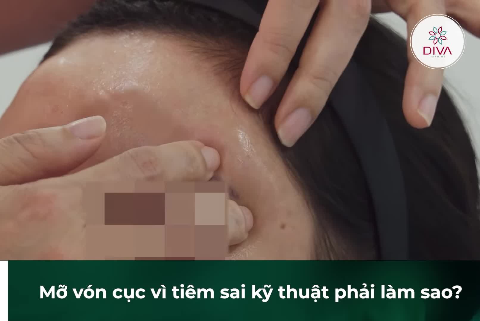 ĐIỆP KHÚC CẤY MỠ LỖI LẶP ĐI LẶP LẠI!