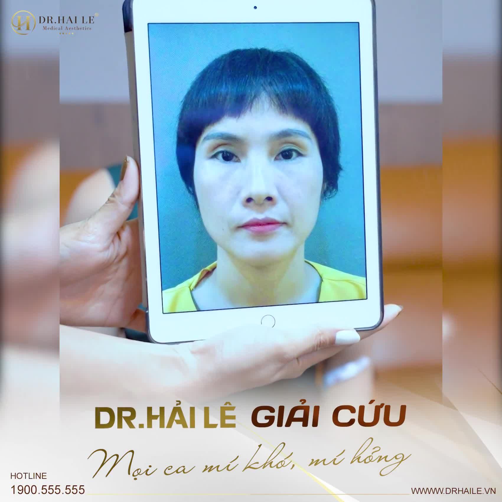 Một phép màu cho đôi mắt lỗi hỏng  Chỉ cần bạn trao niềm tin  Dr.Hải Lê trao cho bạn sự tự tin!