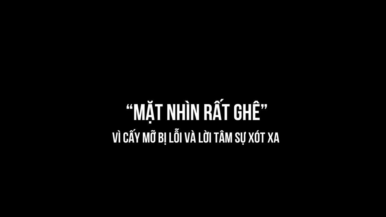 “MẶT NHÌN RẤT GHÊ” VÌ CẤY MỠ LỖI VÀ LỜI TÂM SỰ XÓT XA