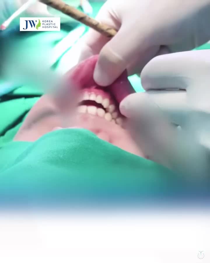 PHẪU THUẬT HÀM MÓM chìa khóa thay mặt ĐỔI VẬN thăng tiến LƯƠNG CAO