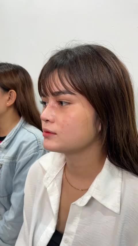BA CHỊ EM ĐẾN TỪ BẠC LIÊU TÁI KHÁM SAU 10 NGÀYNÂNG MŨI BỌC SỤN TẠI TUẤN LINH