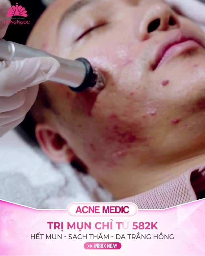 GIẢI QUYẾT NỖI LO VỀ MỤN VỚI CÔNG NGHỆ ACNE MEDIC