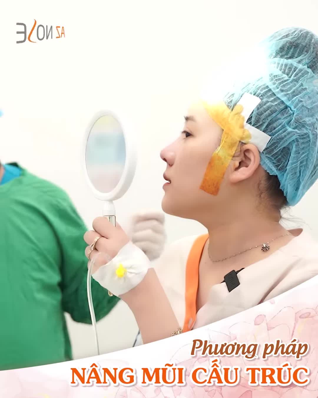 Khuôn mặt thay đổi nhận hổng ra sau ca nâng mũi cấu trúc