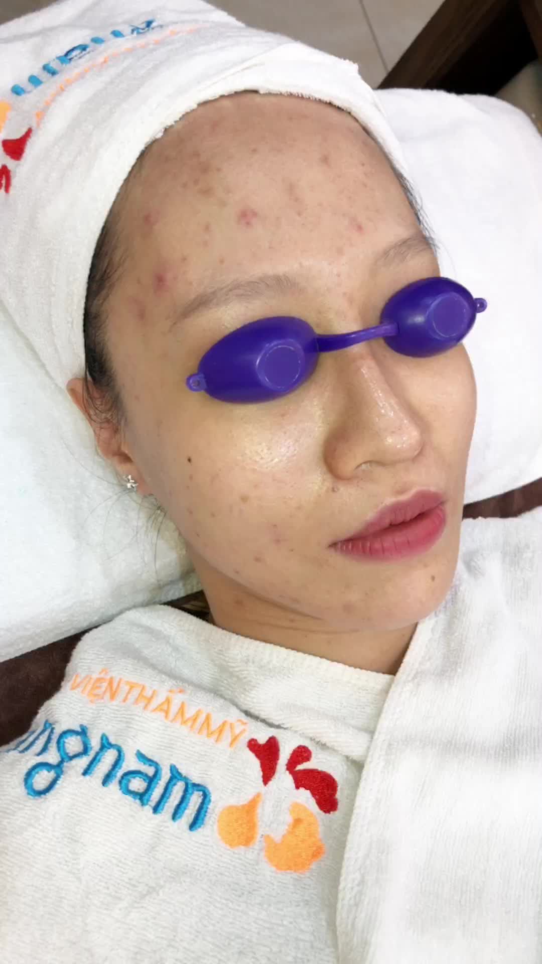 Mụn viêm vô cùng nghiêm trọng  Ảnh hưởng quá nặng nề